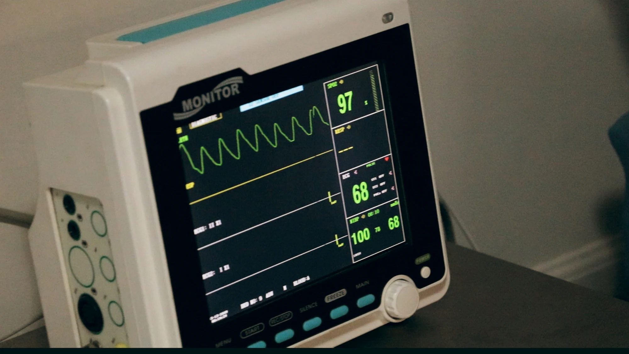 A bedside monitor displaying physiological waveforms in a clinical ward.
